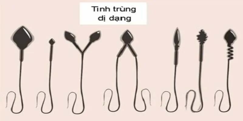 Các bất thường về cấu trúc tinh trùng
