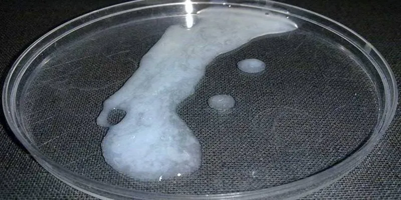 Hình dáng của tinh trùng