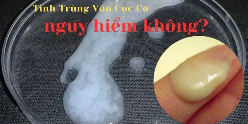Tinh trùng vón cục có nguy hiểm không?