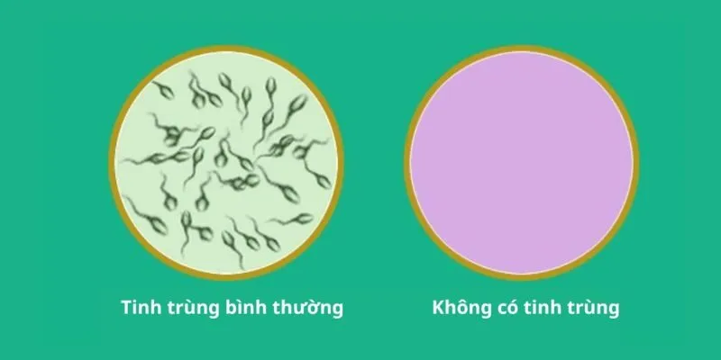 Hút thuốc lá làm chất lượng tinh trùng yếu