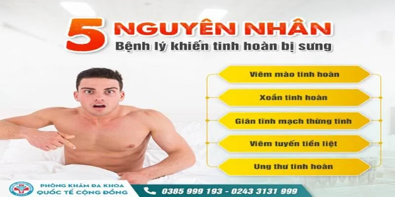 Nguyên nhân gây viêm tinh hoàn