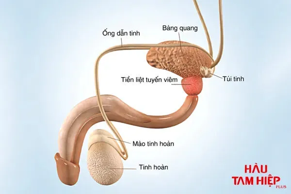 Viêm tuyến tiền liệt có nguy hiểm không? Viêm tuyến tiền liệt uống thuốc gì?